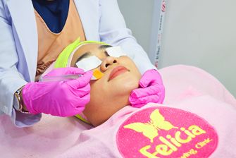 Felicia Chemical Peeling