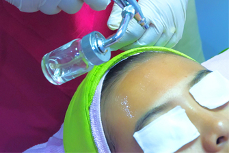 Felicia Mechanical Peeling