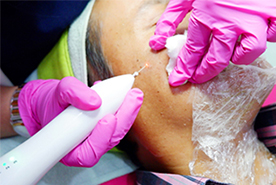 Felicia Cauter Treatment